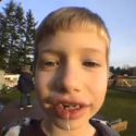 tooth yankin’ methods – part 1